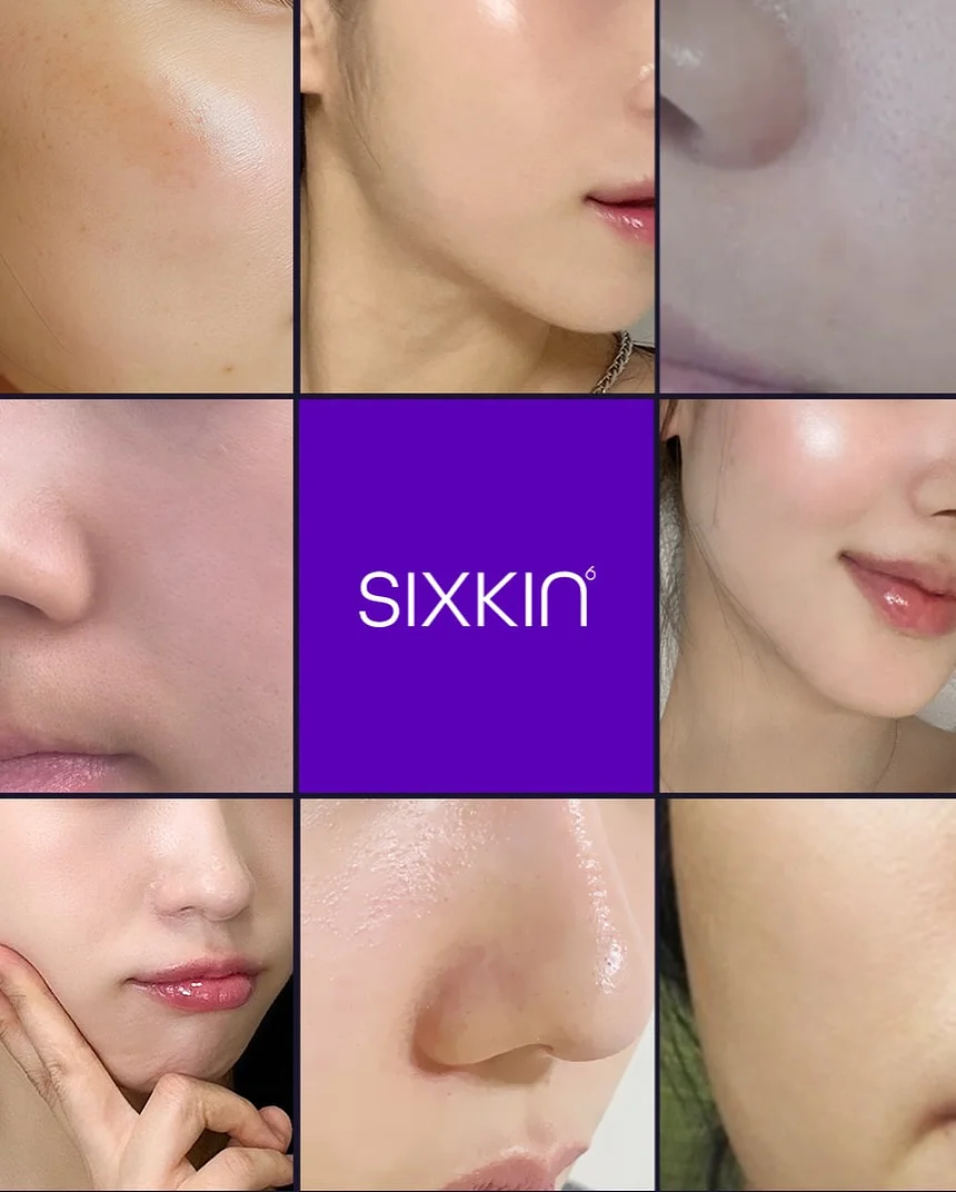 시카겔 9