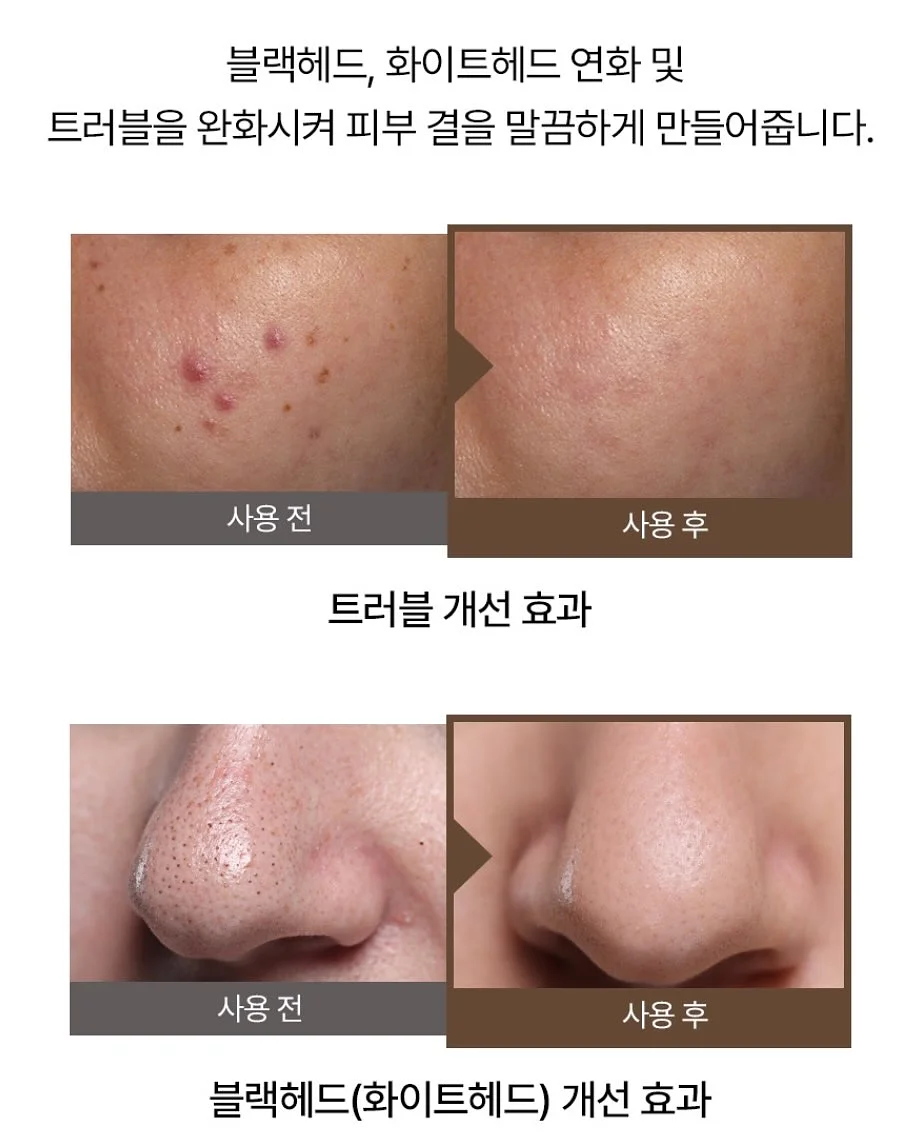 포켓픽 중문 9
