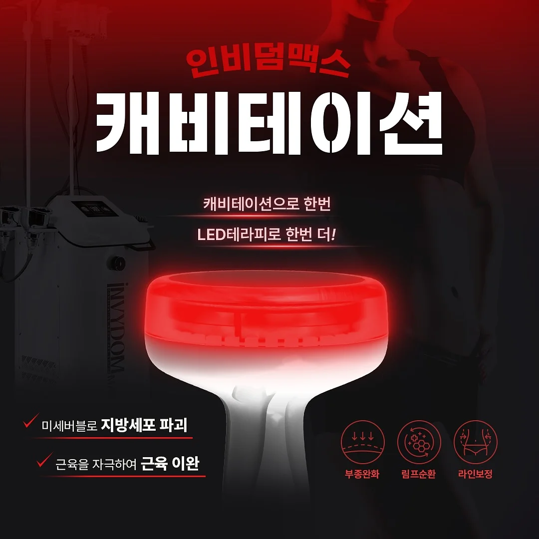 레이스 소재 옷 2