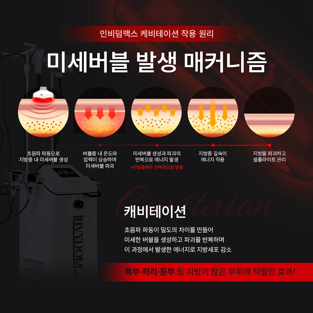 레이스 소재 옷 3