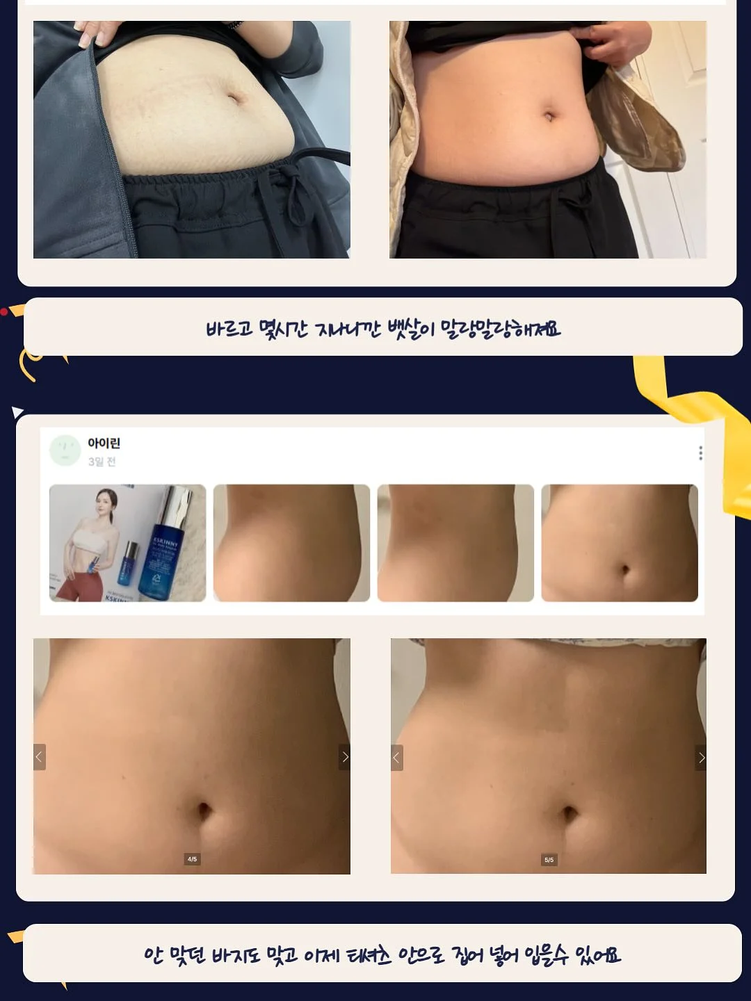 카네이션 꽃다발 16