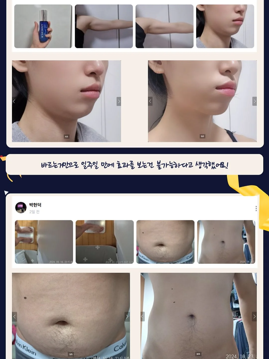 카네이션 꽃다발 17