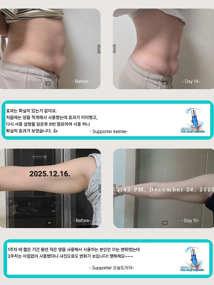 카네이션 꽃다발 5
