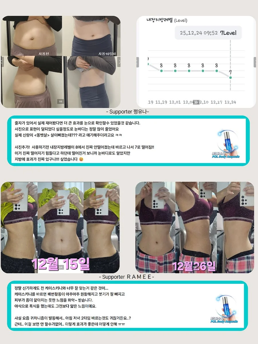카네이션 꽃다발 6
