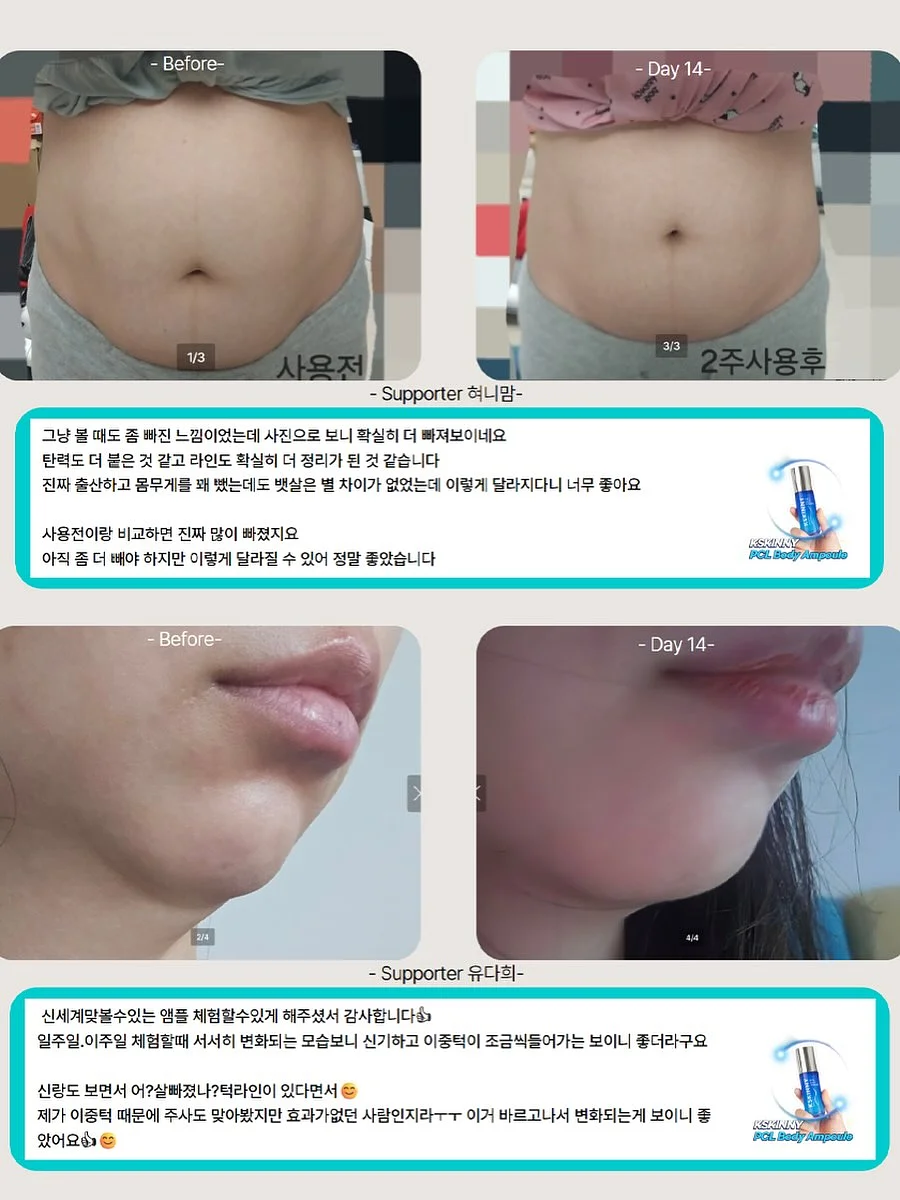카네이션 꽃다발 8