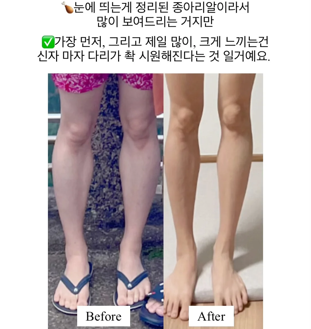 오가닉스 포리지 3