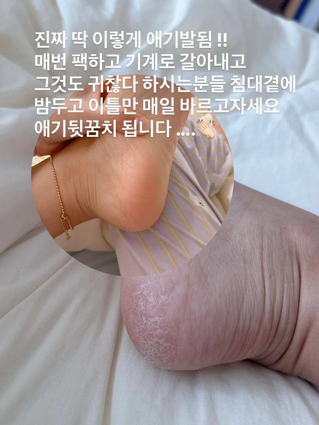 리틀리 화이트 아치 듀얼 미러 8