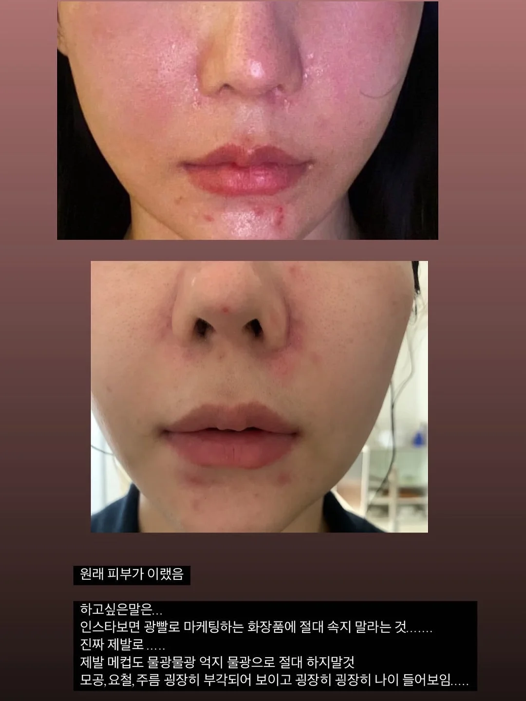 꼬꼬마 카라 바디수트 2