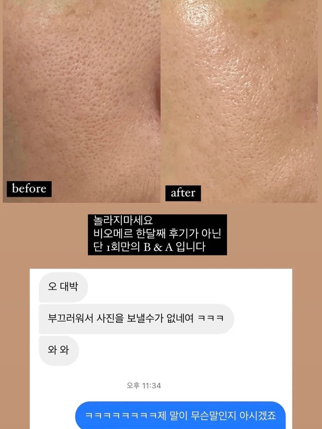 꼬꼬마 카라 바디수트 5