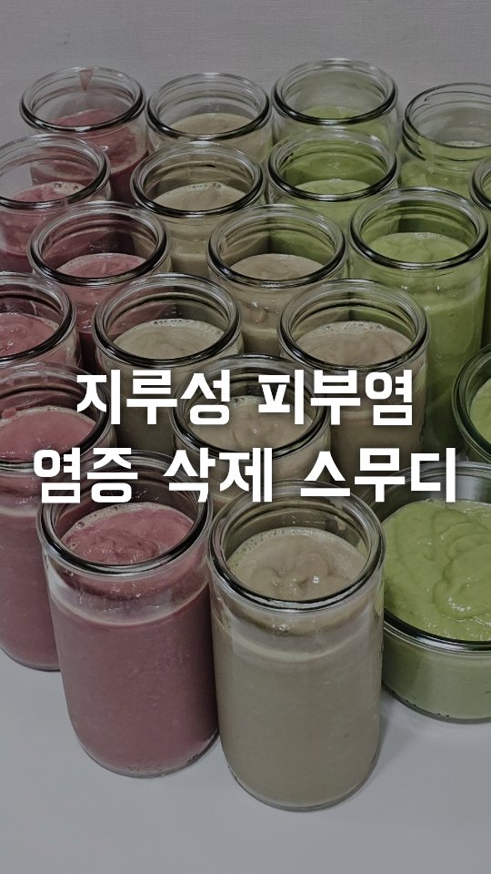 액자형 빔프로젝터