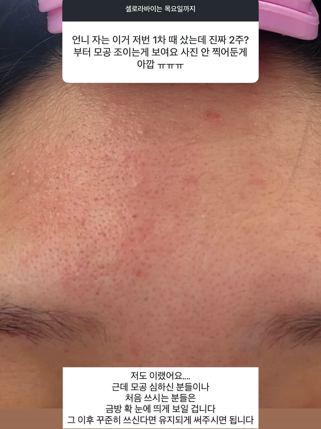쉬젤내열유리용기 9