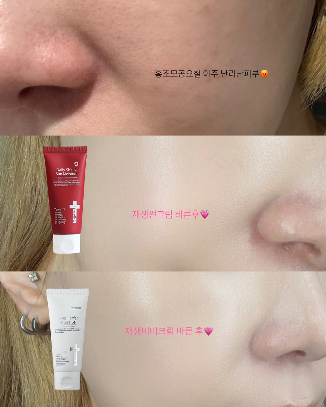 피부·윤곽·바디 관리 7