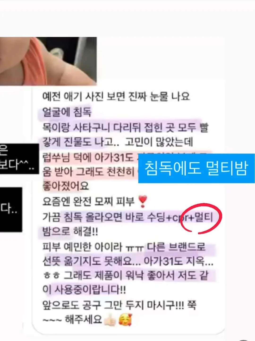 곰돌렌 파티팩 2