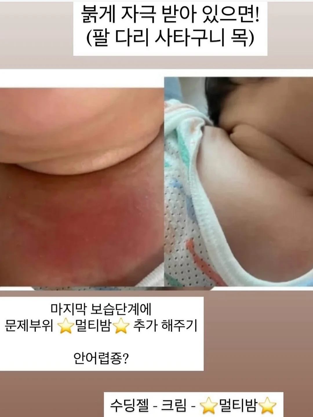 곰돌렌 파티팩 3