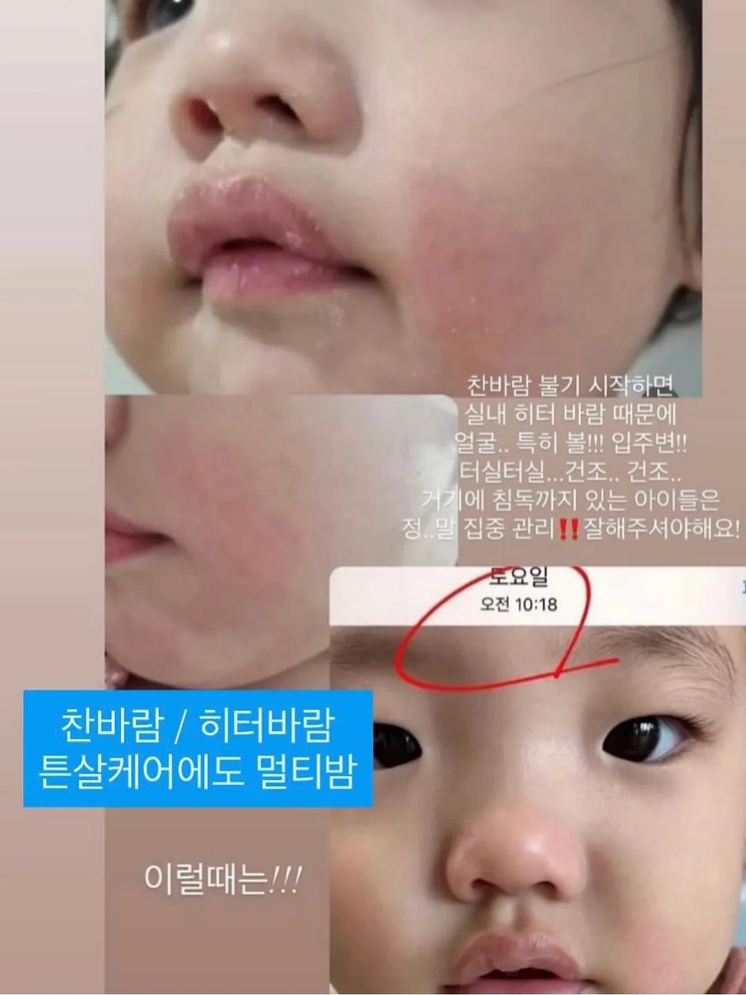 곰돌렌 파티팩 5