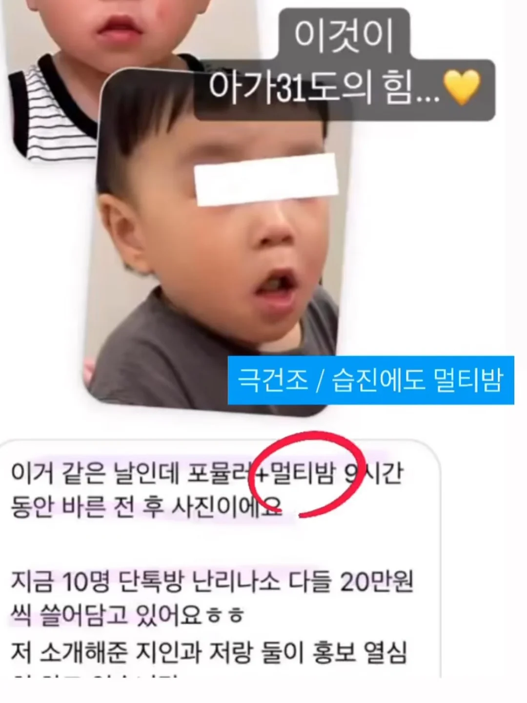 곰돌렌 파티팩 6