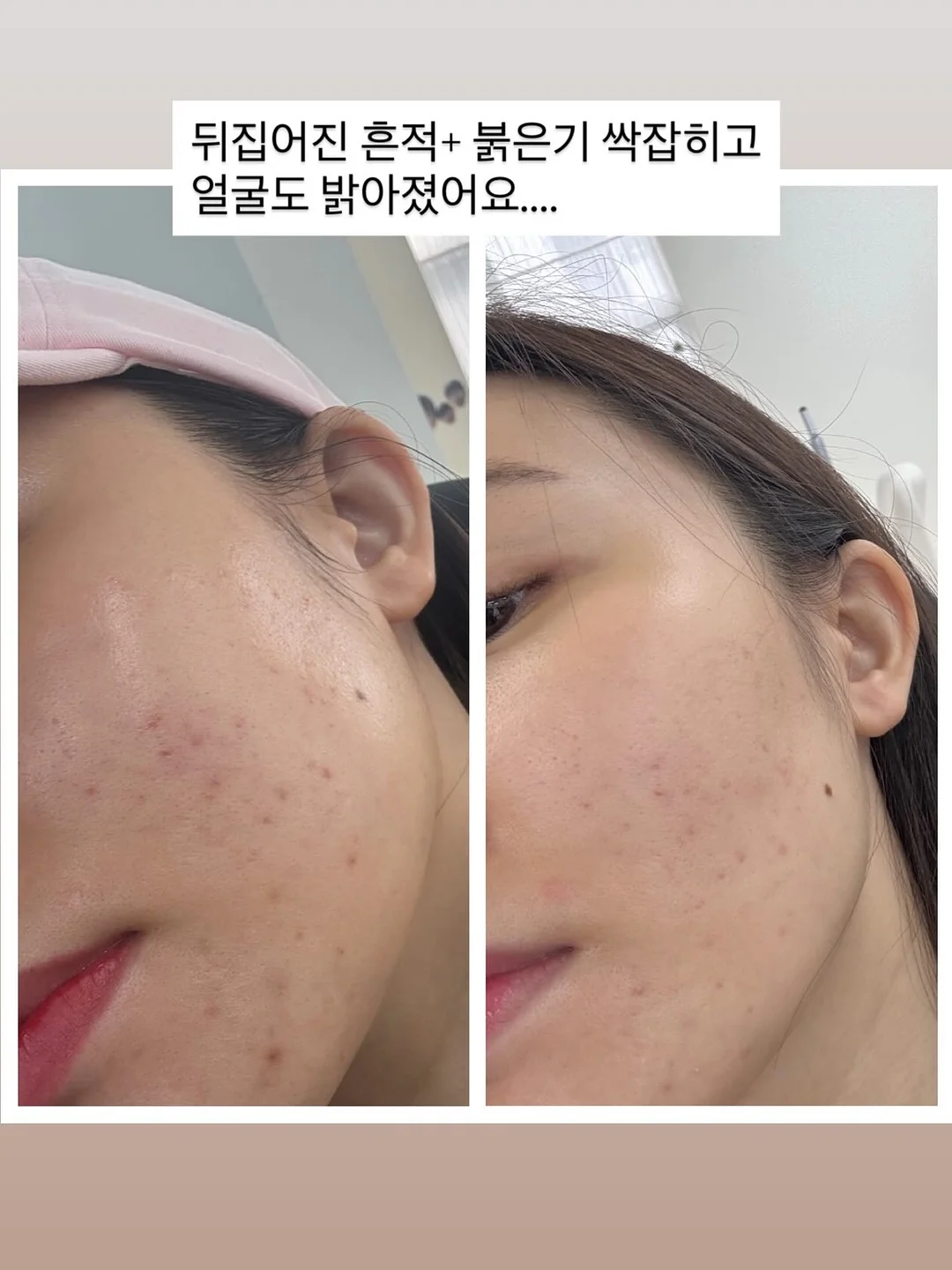 성주 1등 농가 프리미엄 참외 2kg 9