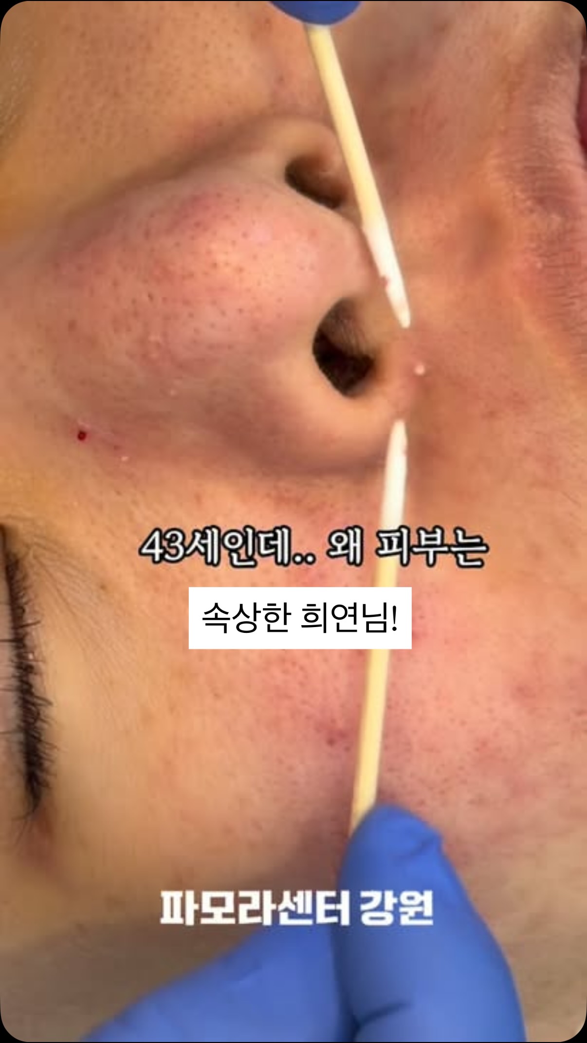 다과 세트