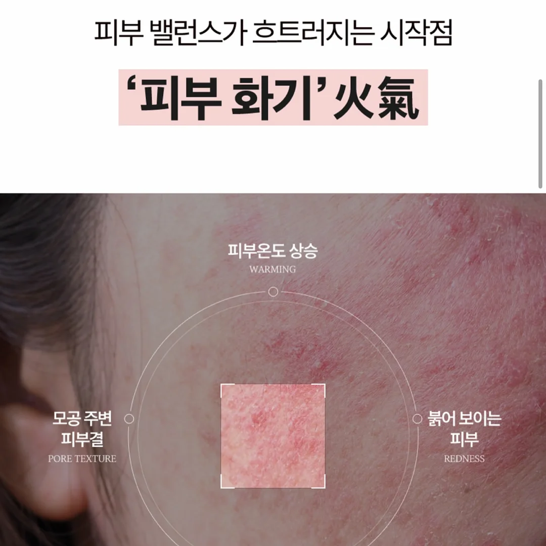 얼음팩 2