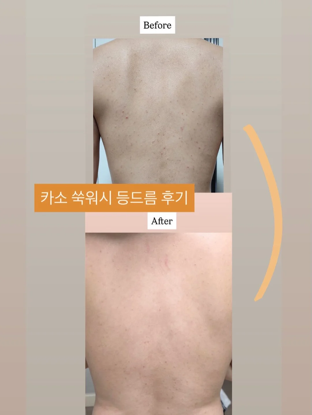 베이지크 CE 선크림 7