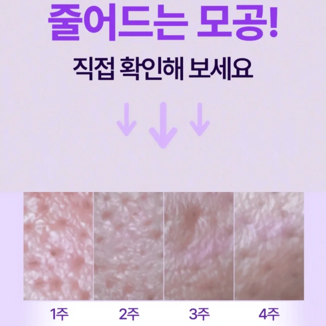 구움이 5
