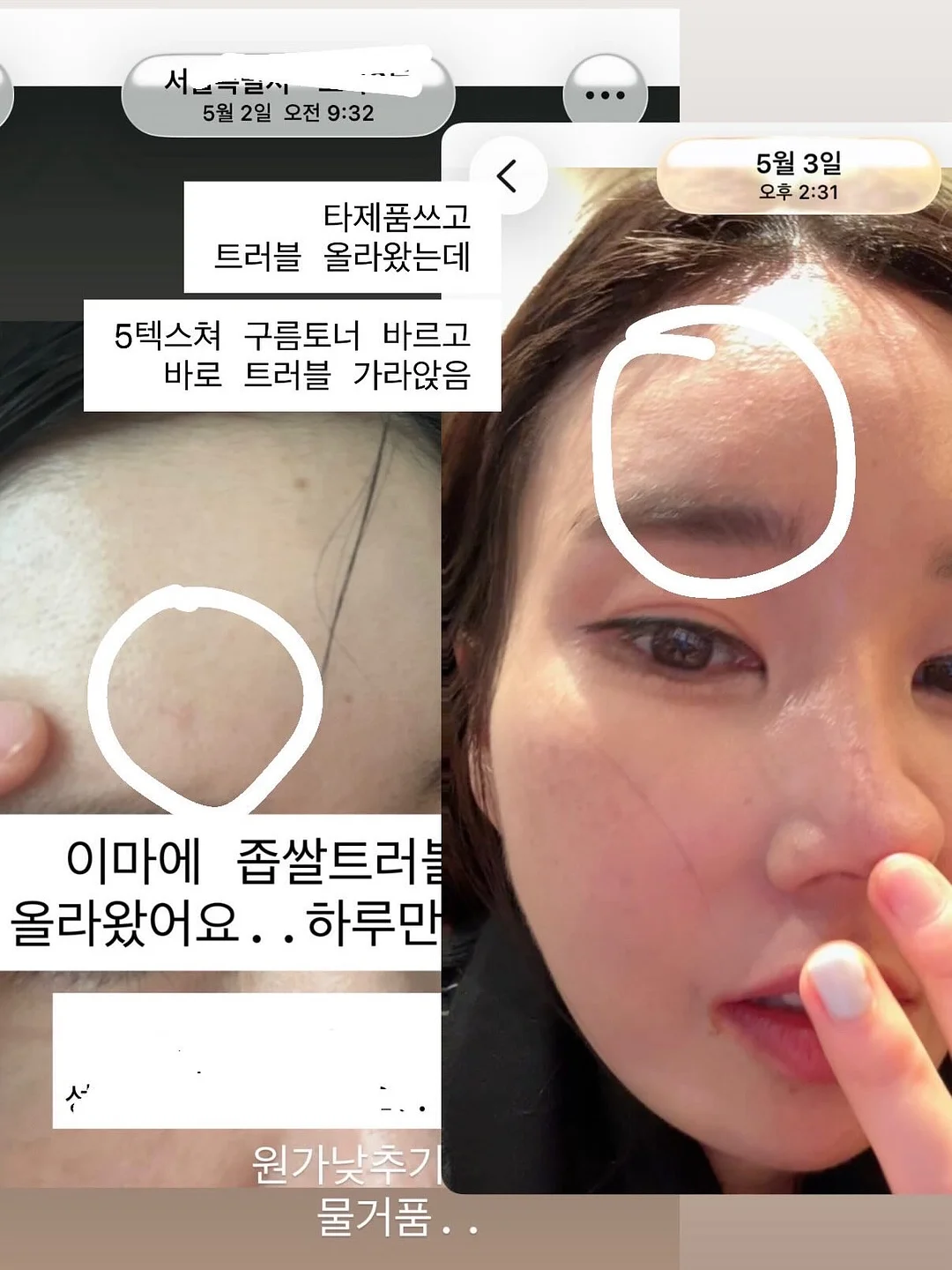 움베르타 5