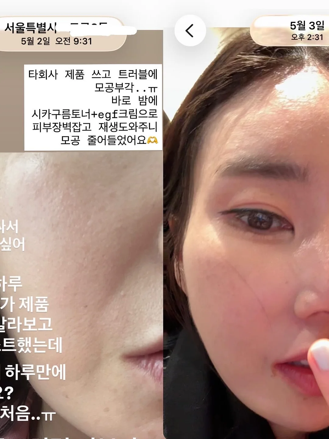 움베르타 6