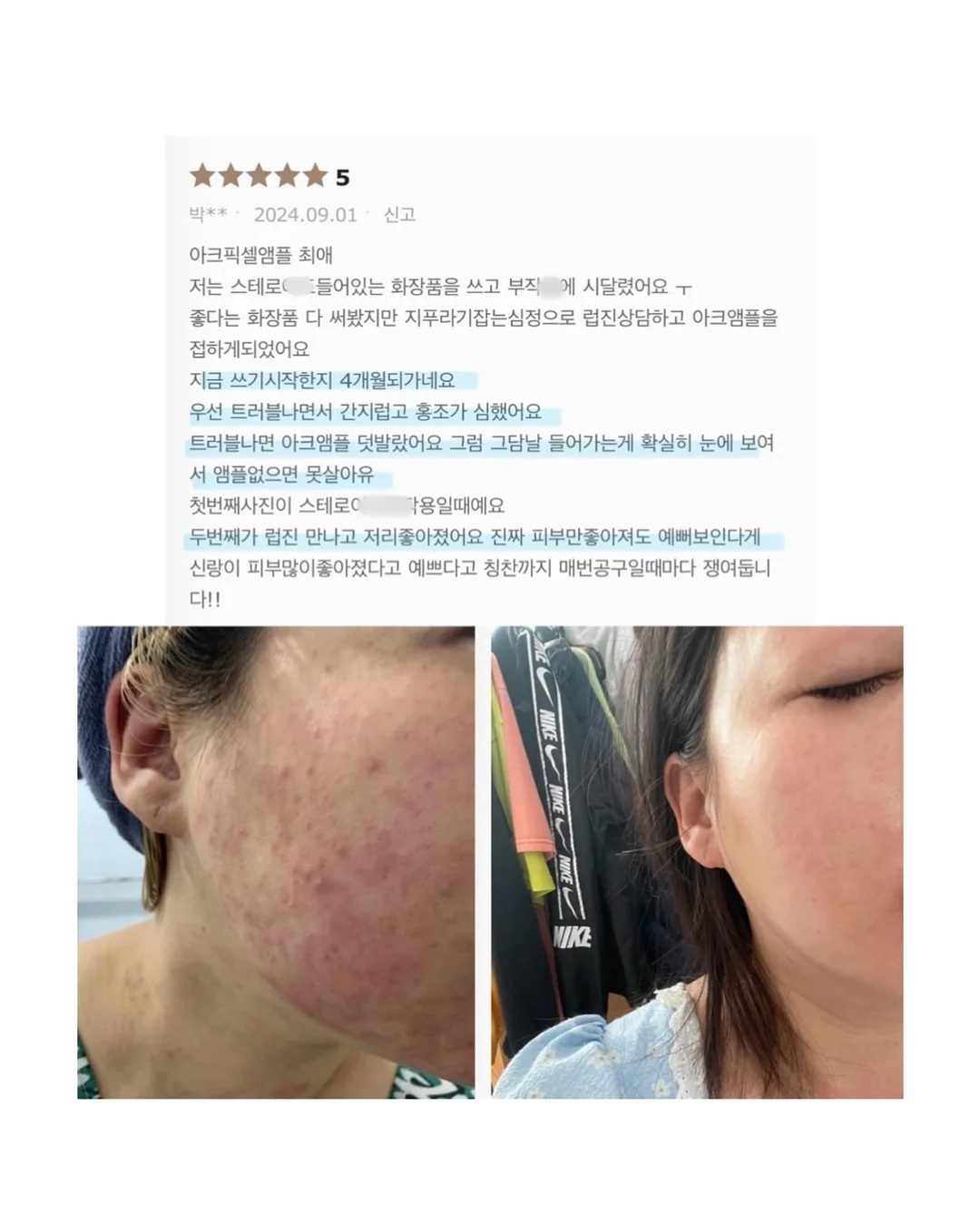 SNP 대왕패치 1