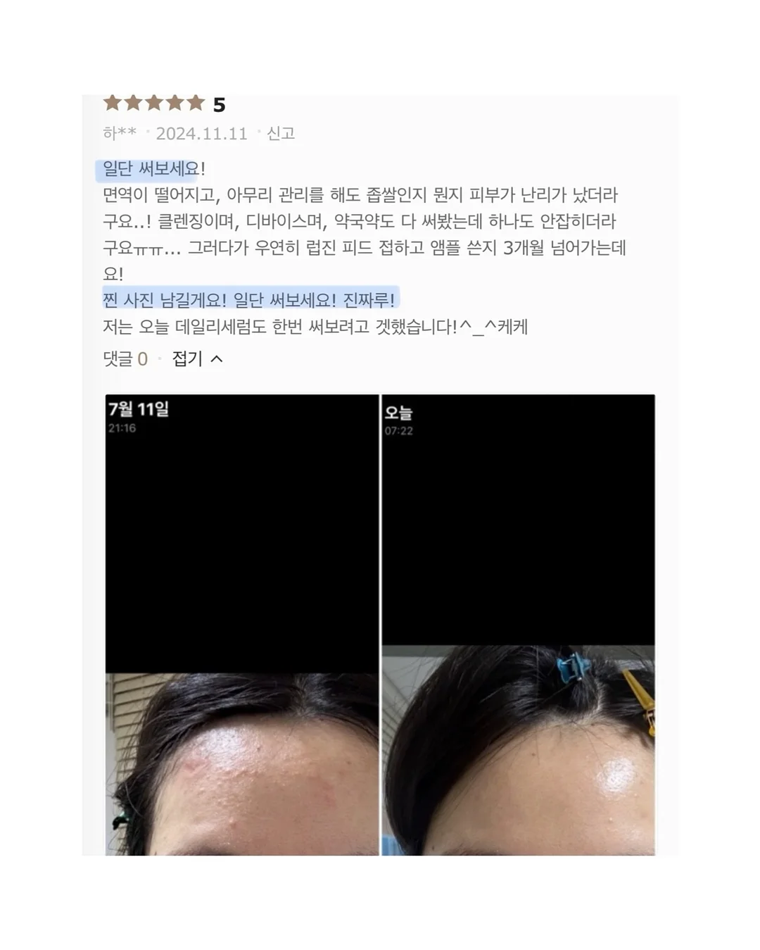 SNP 대왕패치 11