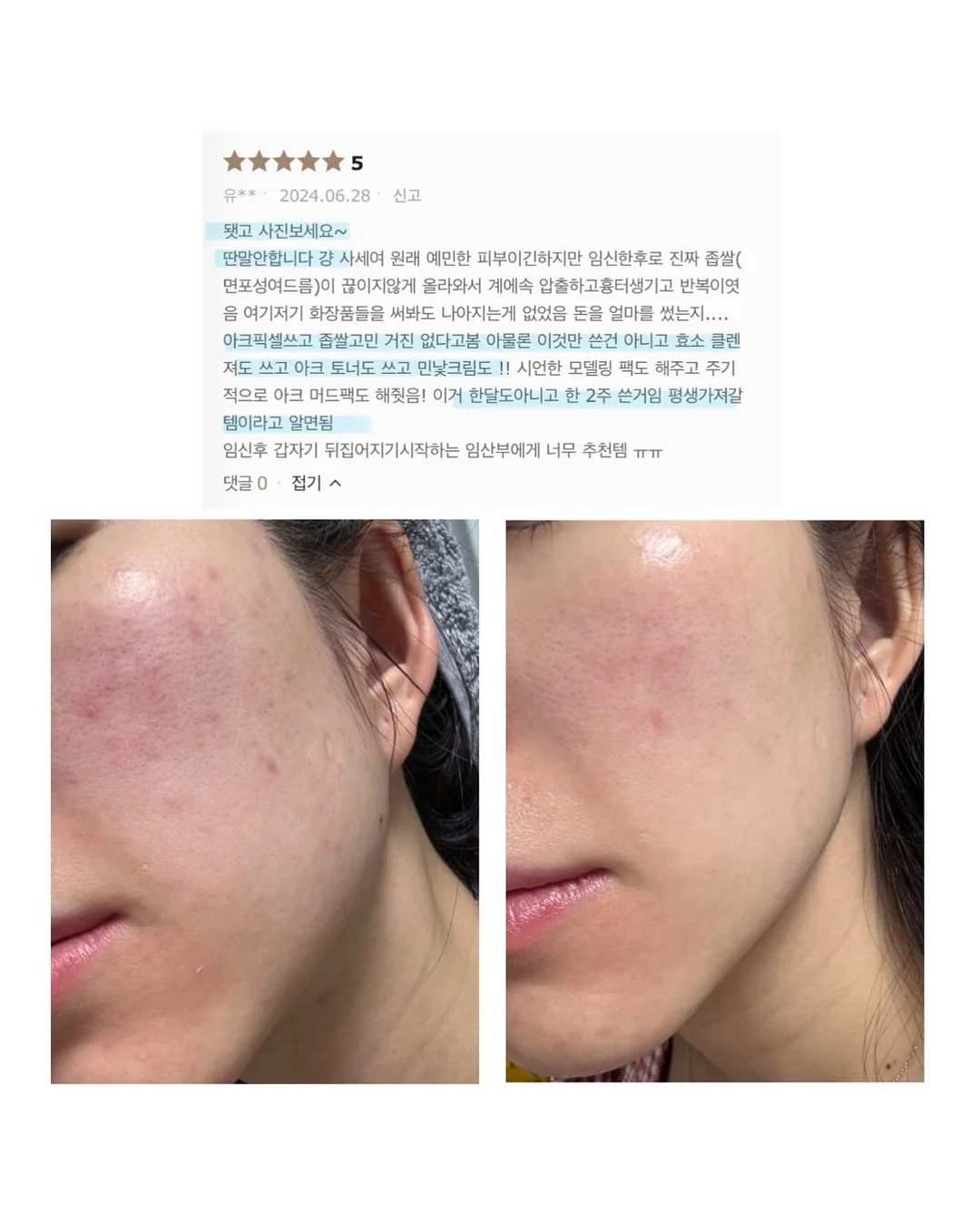 SNP 대왕패치 2