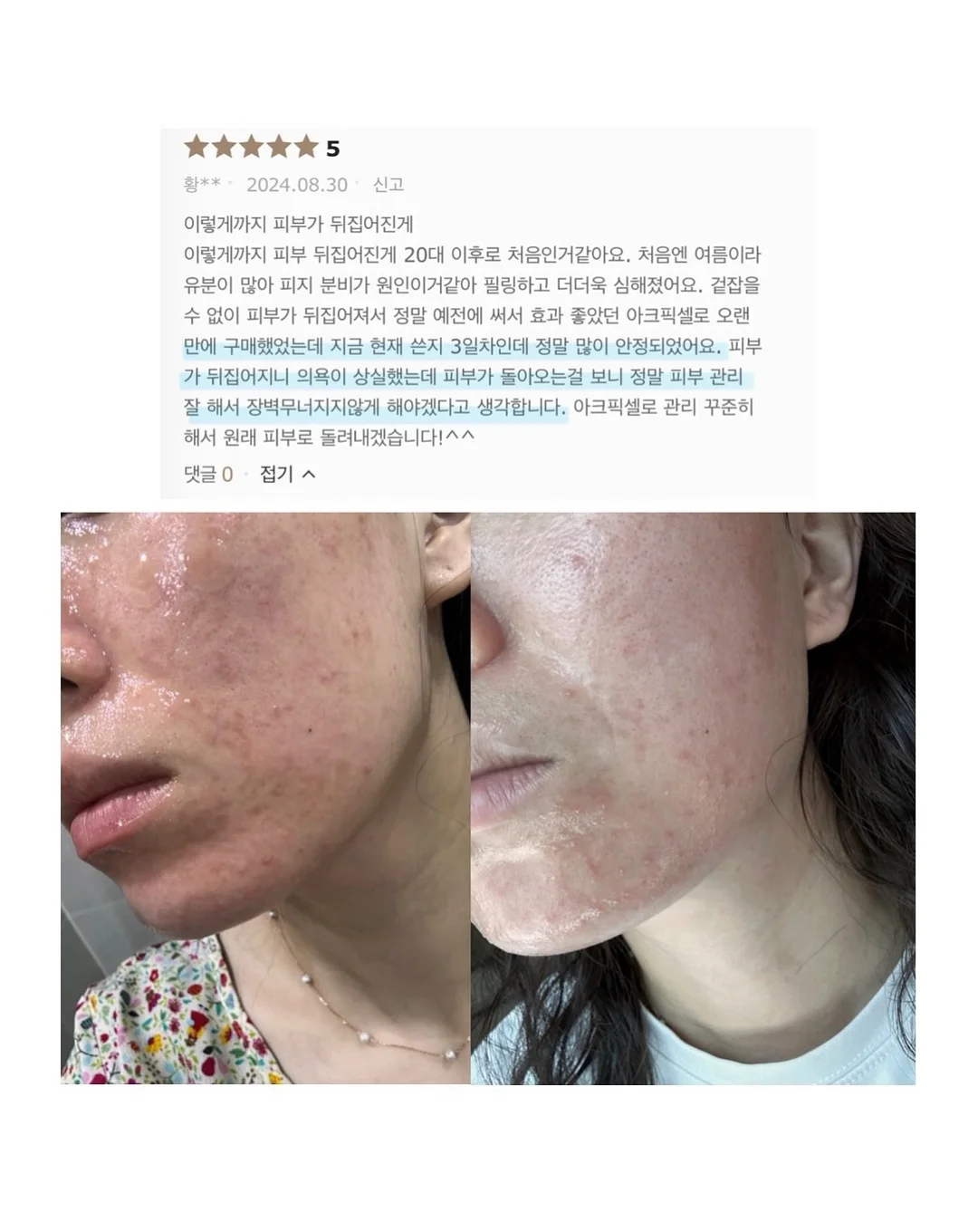 SNP 대왕패치 3