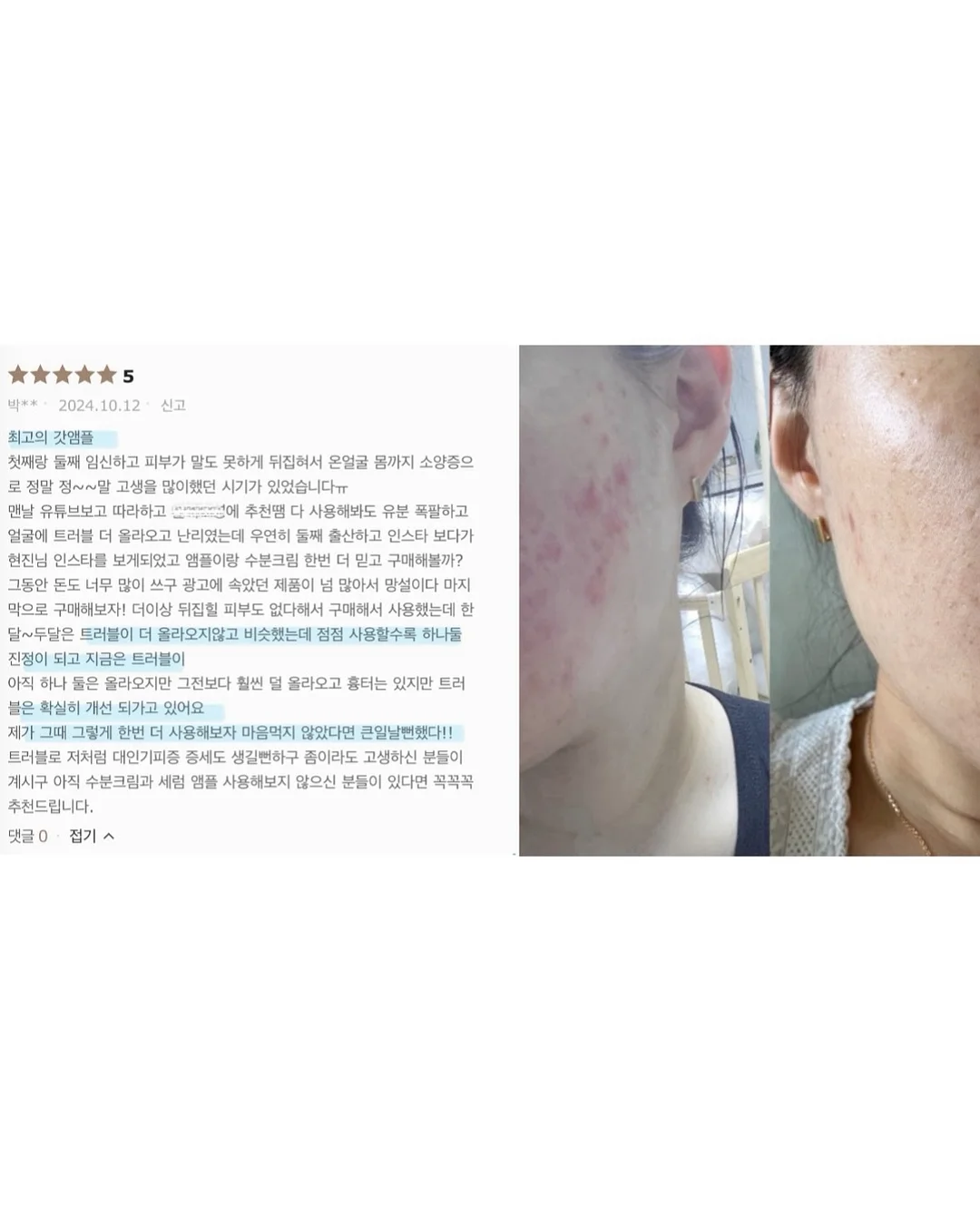 SNP 대왕패치 4