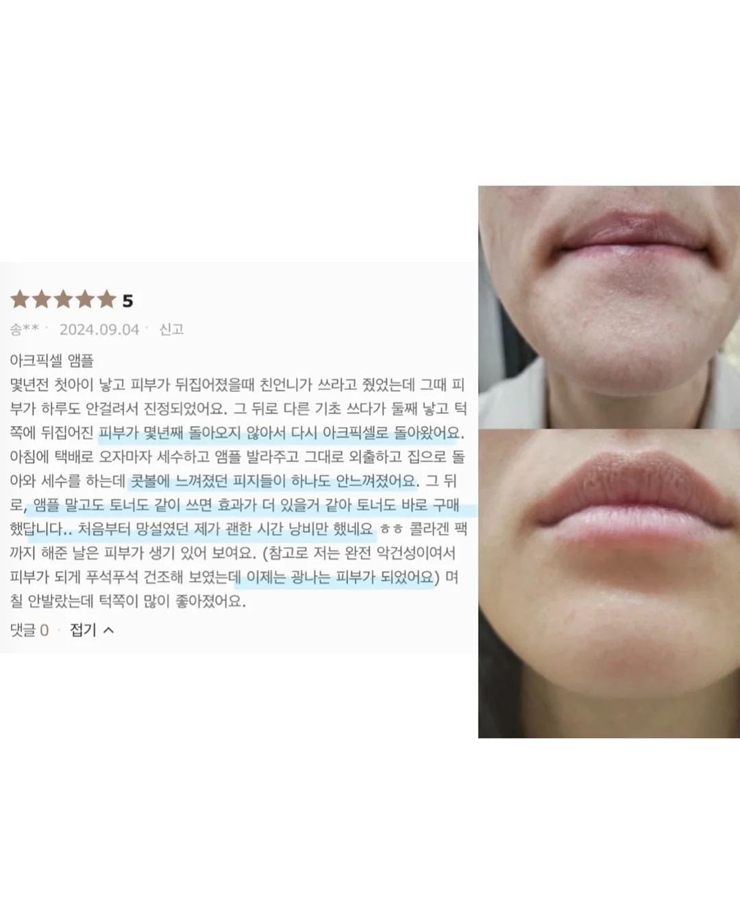 SNP 대왕패치 5