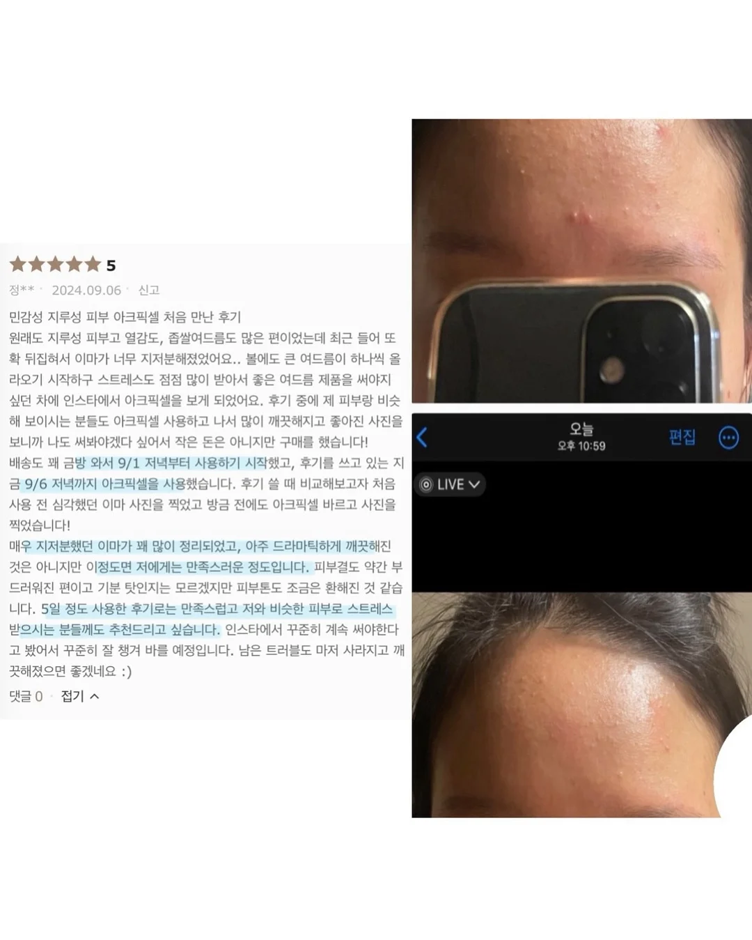 SNP 대왕패치 6
