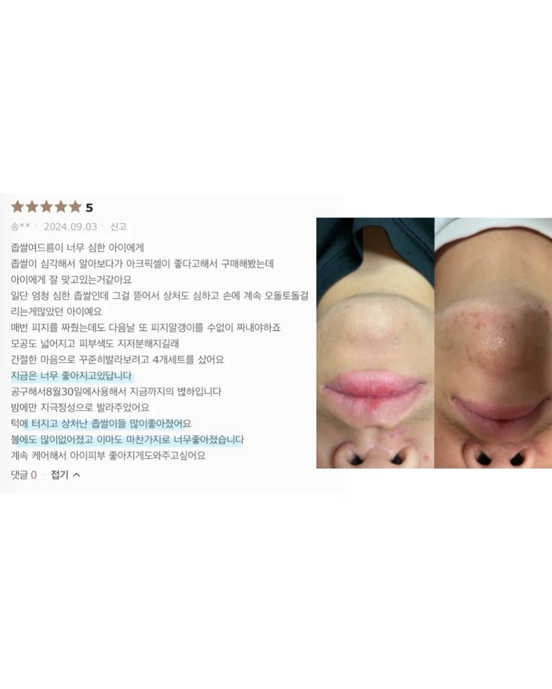 SNP 대왕패치 8