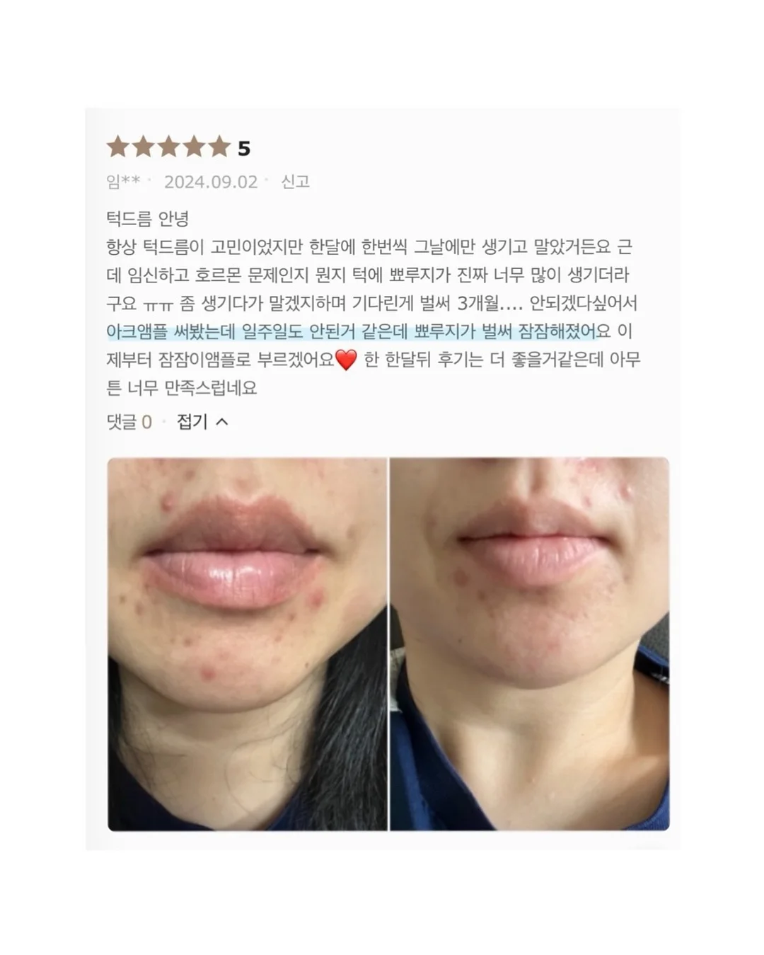 SNP 대왕패치 9