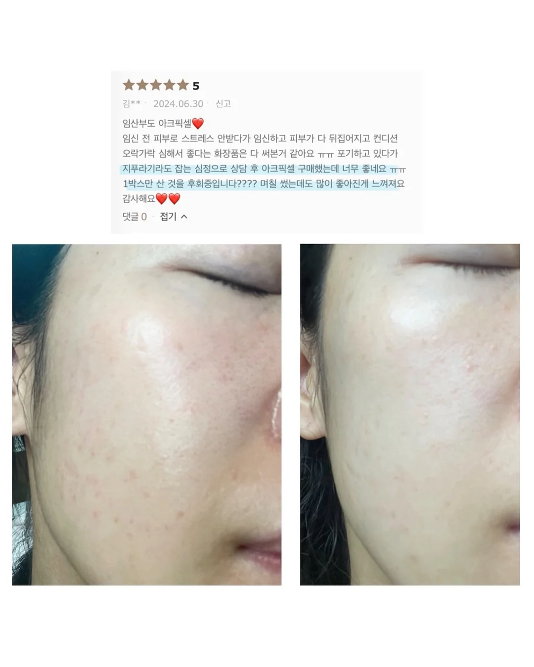 SNP 대왕패치 10