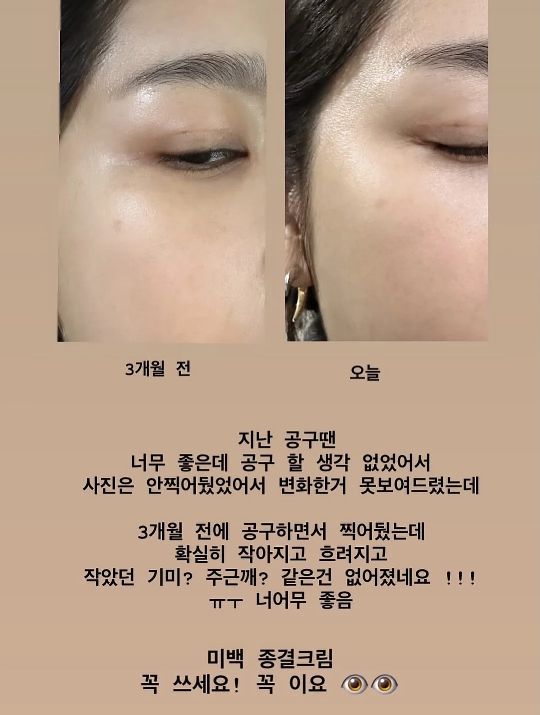 제스프리 루비레드키위 15