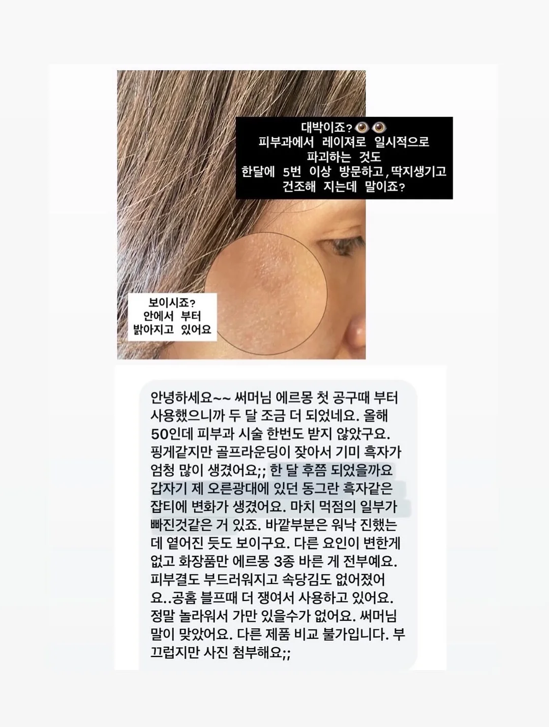 제스프리 루비레드키위 7