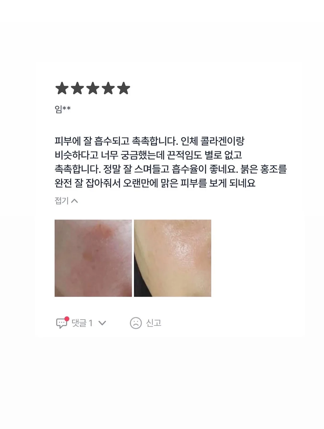 제스프리 루비레드키위 8