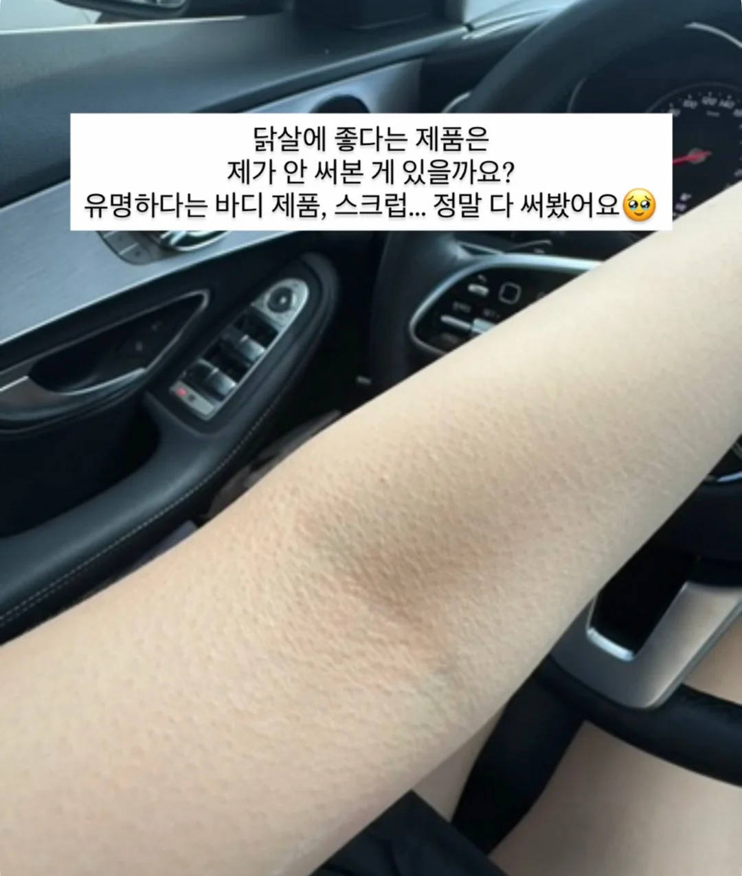 더맨디 노아셋업 4