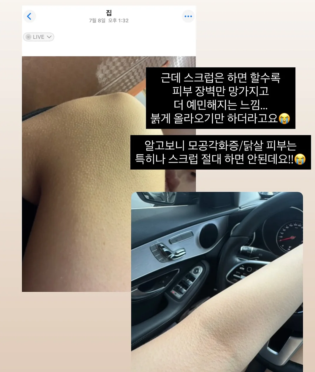 더맨디 노아셋업 5