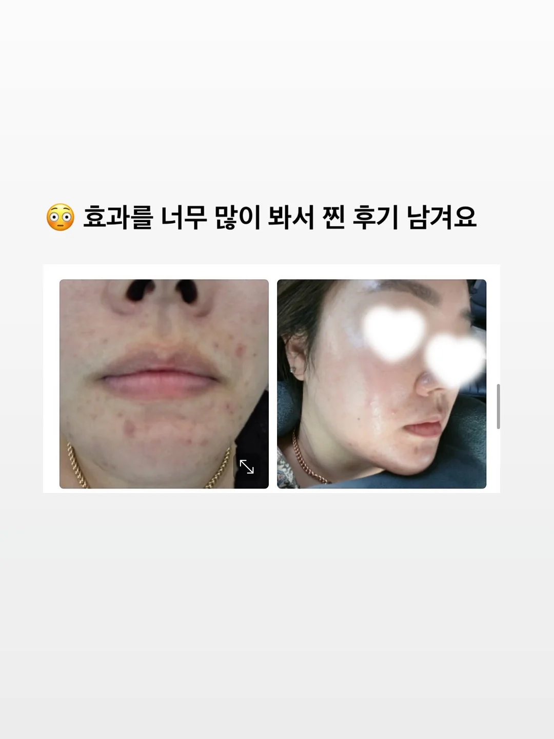 병솔나무 1
