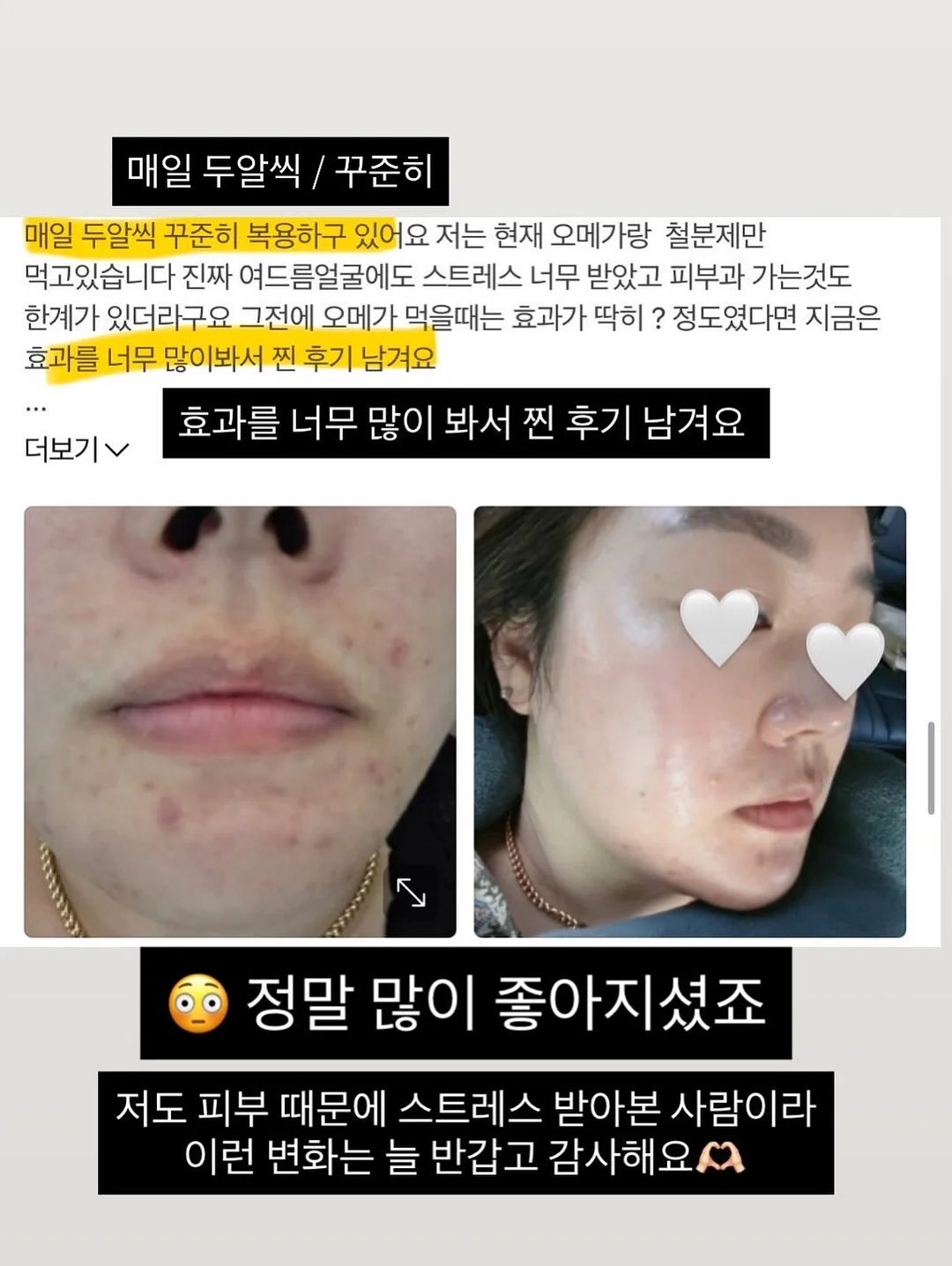 병솔나무 2