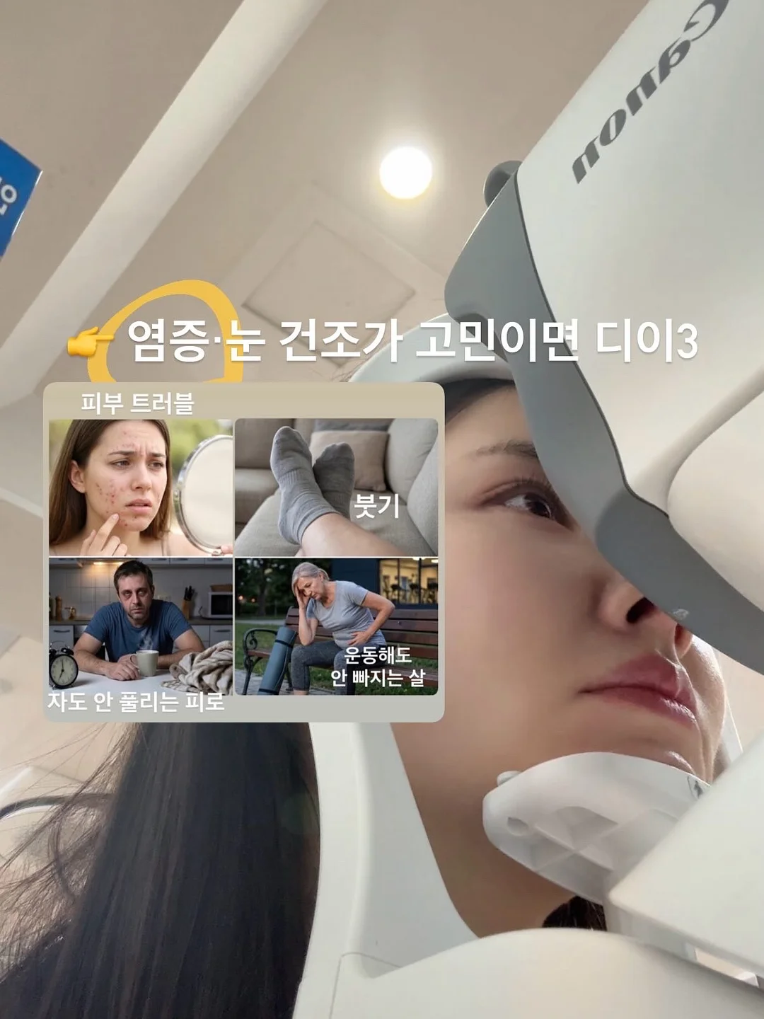 병솔나무 5