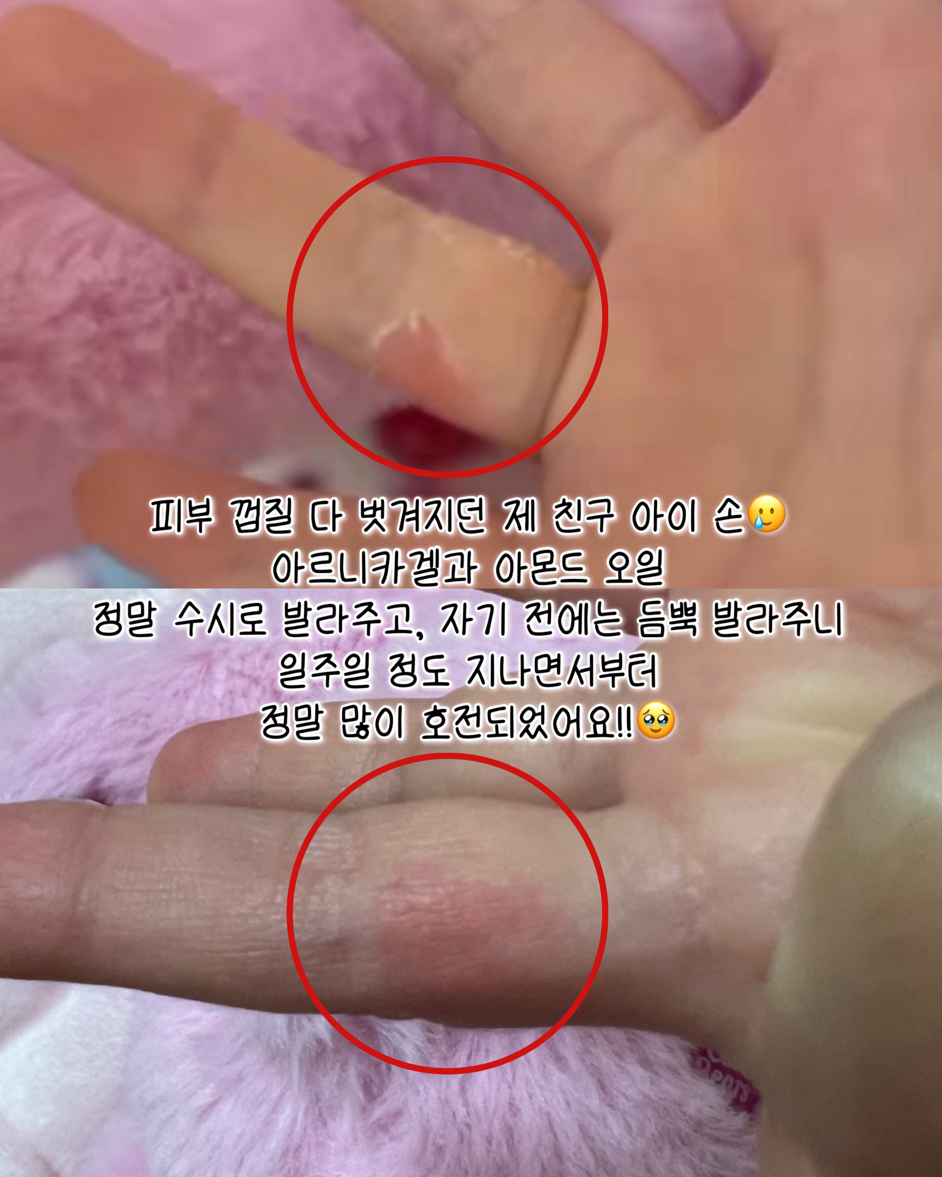 포근한방 심리상담/교육/프로그램 5