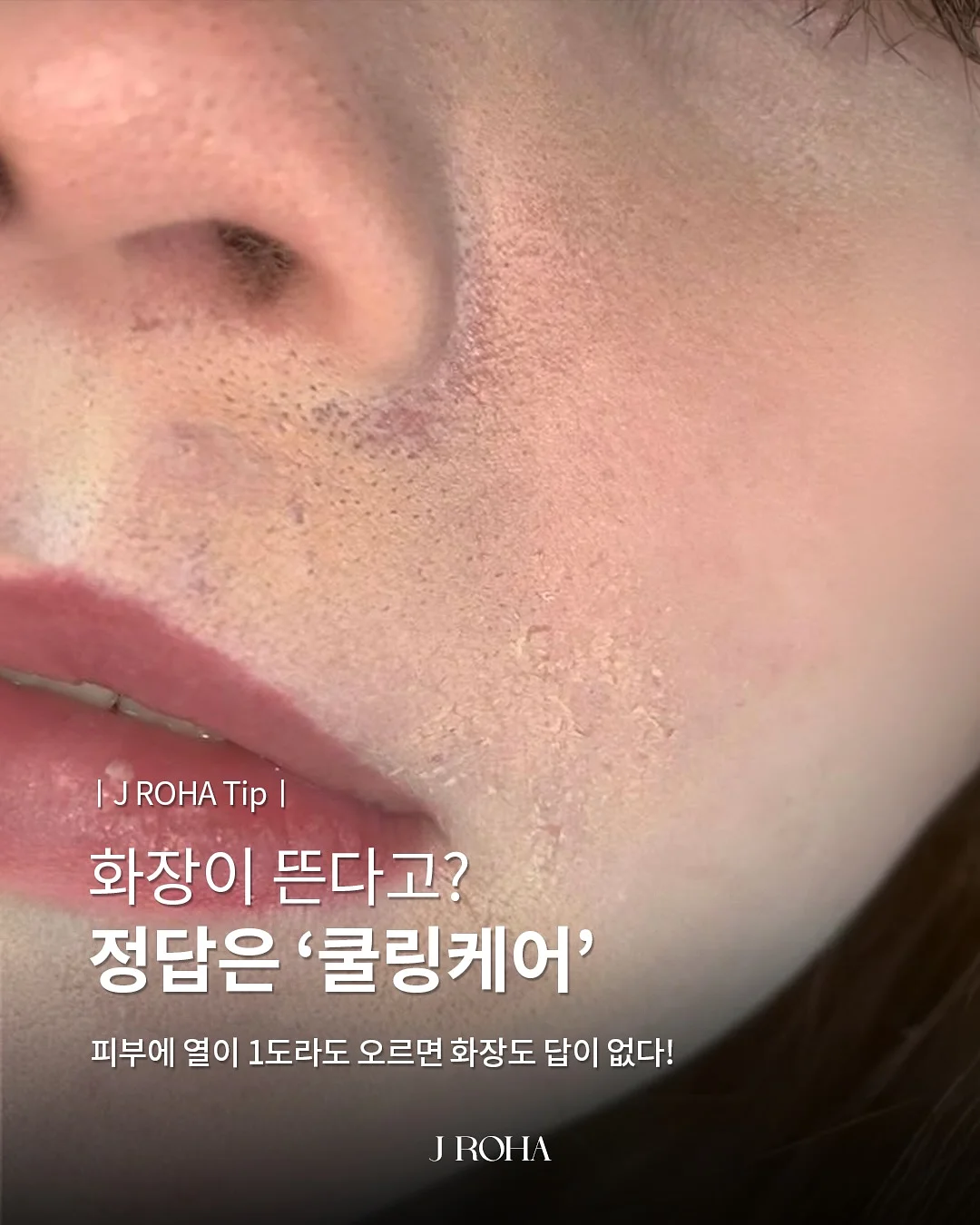 밀키튼 칼슘 단백질 1