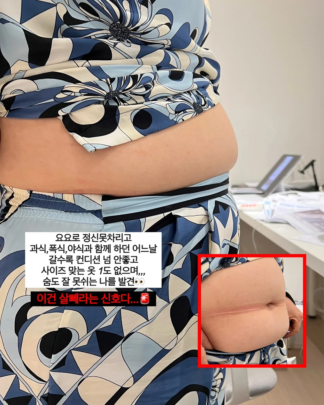 5부 버뮤다 슬랙스 13