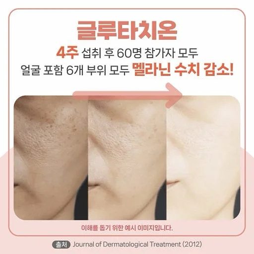 셀틱 가디건 6
