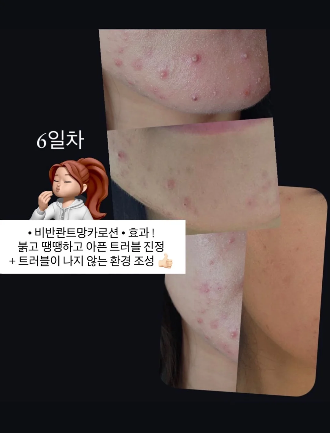 계란 우유 레시피 2